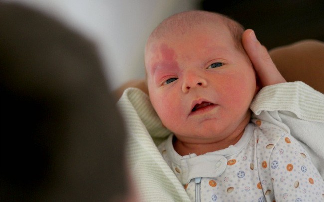 Mẹ bầu sinh con ra mặt mũi bầm tím do thói quen ăn uống cực có hại này trong thai kỳ